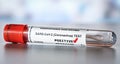 Coronavirus test concept - vial sample tube with cotton swab, red checkmark next to word positive, Sticker is own design with Royalty Free Stock Photo