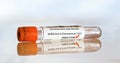 Coronavirus test concept - vial sample tube with cotton swab, red mark next to word positive Sticker is own design with dummy Royalty Free Stock Photo