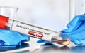 Coronavirus test concept - vial sample tube with cotton swab, word positive circled in red, blurred lab equipment and blue nitrile Royalty Free Stock Photo