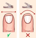 Correct and incorrect fingernail cut