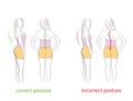 Correct and incorrect posture. side and rear view. medical recommendations. vector illustration.