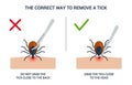 The correct way to remove a tick insect correctly. Infographic tips for tick safety