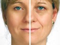 Correction of wrinkles - half of face Royalty Free Stock Photo