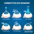 Corrective eye surgery vector illustration. Laser process education scheme. Royalty Free Stock Photo