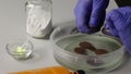 Corroded copper coins. They lie in a container with phosphoric acid. The man checks the degree of their cleaning