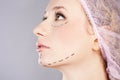 Cosmetic botox injection, in the female face Royalty Free Stock Photo