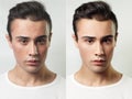 Before and after cosmetic operation. Young pretty man portrait Royalty Free Stock Photo