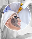 The cosmetologist makes carbon face peeling procedure in a beauty salon. Hardware cosmetology treatment in the beauty salon Royalty Free Stock Photo