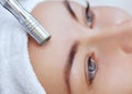 The cosmetologist makes the procedure Microdermabrasion of the facial skin of a beautiful, young woman in a beauty salon. Royalty Free Stock Photo