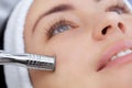 The cosmetologist makes the procedure Microdermabrasion of the facial skin of a beautiful, young woman Royalty Free Stock Photo