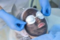 Cosmetologist preparing woman patient to carbon laser peeling procedure.