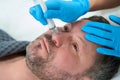 Cosmetologist uses the non-surgical microdermabrasion method in his work