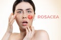 Cosmetology and dermatology. Portrait of a young, beautiful, frightened woman with painted red cheek. Beige background