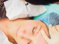 Cosmetology procedure mesoteraphy. Rejuvenation revitalization, skin nutrition, wrinkle reduction. Doctor making microneedle injec