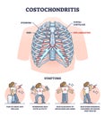 Costochondritis as chest wall pain or costosternal syndrome outline diagram