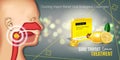 Cough Drops ads. Vector 3d Illustration with lemon pills for throat.