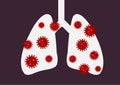 Covid-19 Virus in Human Lung and Respiratory System Royalty Free Stock Photo
