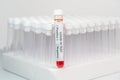 COVID-19 infection blood test sample and empty vacuum venipuncture tubes Royalty Free Stock Photo