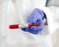 COVID-19 Negative Blood Vial Royalty Free Stock Photo