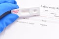 COVID-19 negative test result by using antigen test kit