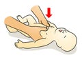 CPR baby by 2 thumbs.