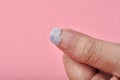 Cracked broken nail, Nail weakness damage from gel polish coating, Fingernail Royalty Free Stock Photo