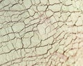 Cracked dry mud mask on skin, texture