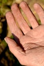 Cracked skin on a workman's hand Royalty Free Stock Photo