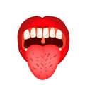 Cracks in the tongue. Definition of a disease according to human tongue. Diagnostics by tongue. Tongue Vector Royalty Free Stock Photo