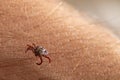 Crawling deer tick on the background of human hairy skin. Dangerous insect infects with disease