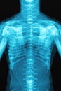 X-ray scan of the human body