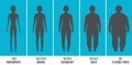 Creative vector illustration of bmi, body mass index infographic chart with silhouettes and scale isolated on Royalty Free Stock Photo
