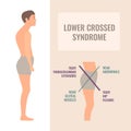 Crooked man with lower crossed syndrome imbalance