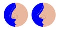 Crooked and straight nose comparison, before and after rhinoplasty correction, vector illustration.