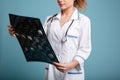 Cropped image of female doctor holding roentgenogram