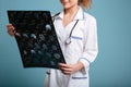 Cropped image of smiling female doctor holding roentgenogram