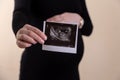 Cropped image of young pregnant woman holding ultrasound picture on belly. Concept of pregnancy, health care, gynecology, medicine