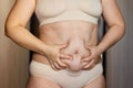 Cropped of overweight fat woman arm squeezing subcutaneous fat on abdomen excess flabs in underwear. Obesity tummy.