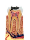 Cross section of a anatomical tooth model