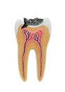 Cross section of a anatomical tooth model Royalty Free Stock Photo