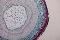 Cross-section Dicot, Monocot and Root of Plant Stem under the microscope.