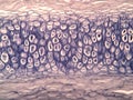 Cross section human cartilage bone