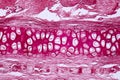 Cross section human cartilage bone under microscope view Royalty Free Stock Photo