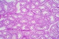 Cross section Human testis under microscope view. Royalty Free Stock Photo