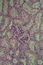 Cross section of the kidney with Glumeroli Royalty Free Stock Photo