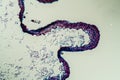 Cross-section through the lichen symbiote body