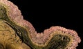 Cross section of a normal stomach showing pyloric mucosa