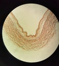 Vena Cava Cross Section