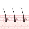 Cross section of the skin Illustrations Sebaceous glands Apocrine sweat glands Eccrine sweat glands