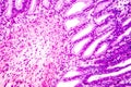 Cross section of stomach. Light micrograph showing stomach epithelium Royalty Free Stock Photo